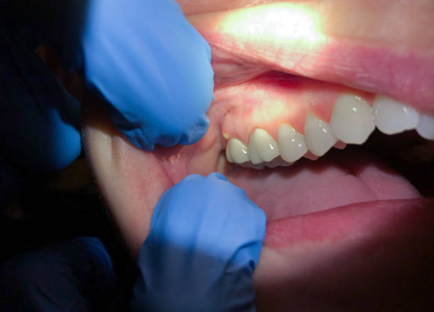 Best Pediatric Emergency Dentist in Gap, PA